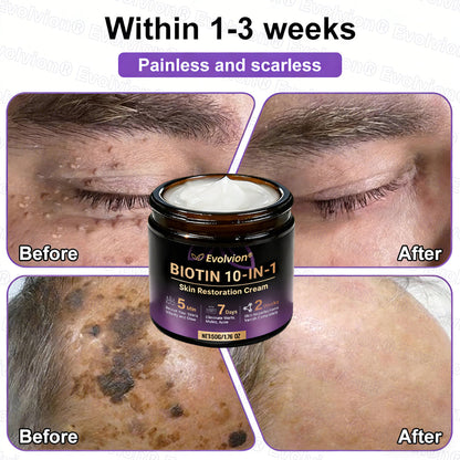 Made and Shipped from USA ✨Evolvion® Biotin 10-in-1 Skin Restoration Cream🌻🌻