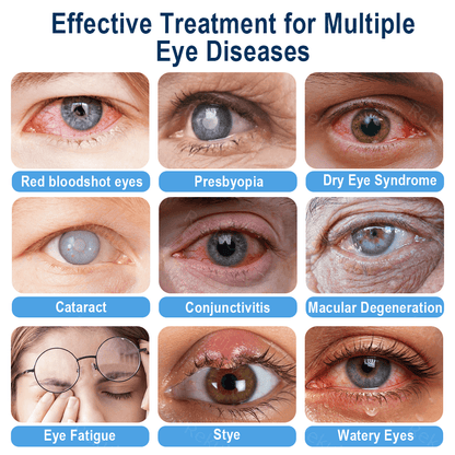 Rekulo® OptiMist Eye Spray✅FDA Approved (For dry eyes, blurry vision, eye strain, presbyopia, and cataracts) 👀☘️