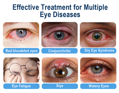 Rekulo® OptiMist Eye Spray✅FDA Approved (For dry eyes, blurry vision, eye strain, presbyopia, and cataracts) ☘️