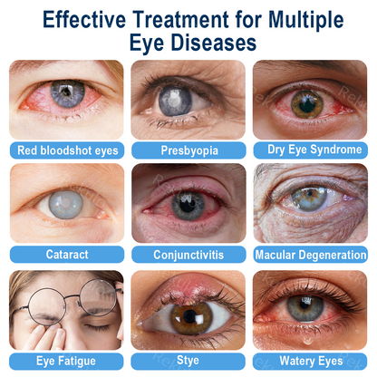 Rekulo® OptiMist Eye Spray✅FDA Approved (For dry eyes, blurry vision, eye strain, presbyopia, and cataracts) 👀 🌻 up