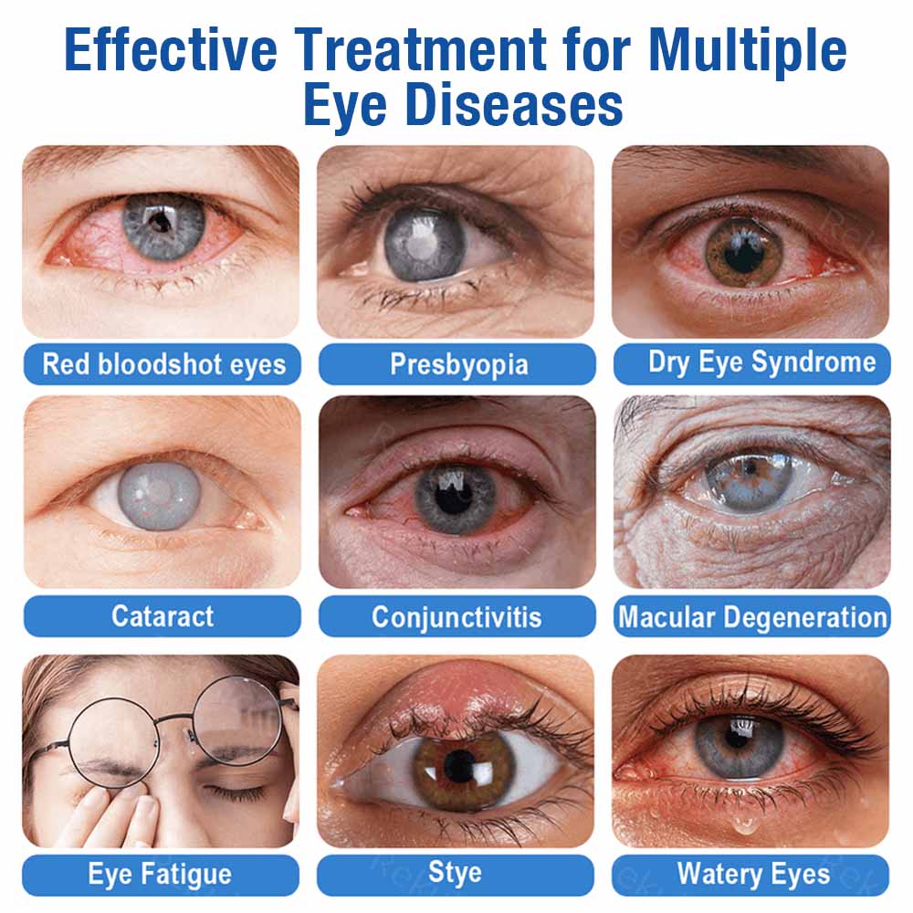 👨‍⚕️ DR.Fachmer® LensClarity Eye Drops✅FDA Approved (For dry eyes, blurry vision & presbyopia) 👀