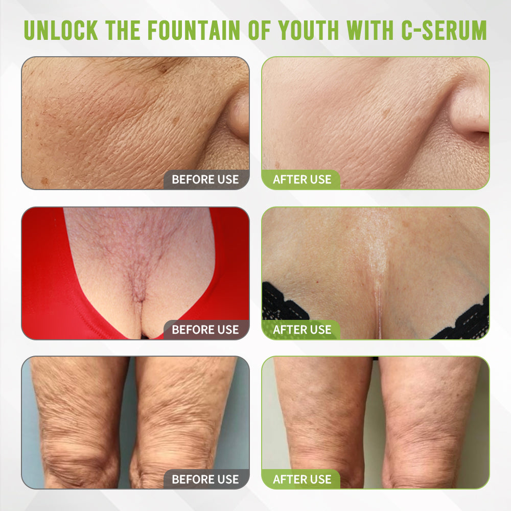👩‍⚕️Rolimey® Kakadu Plum Skin Repair Serum ✅️ FDA Approved | Infused with PDRN Collagen for Eliminating Wrinkles, Stretch Marks, Age Spots