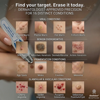 Made and Shipped from USA ✨Evolvion® 𝟕-𝐃𝒂𝘆 𝐒𝗸𝐢𝐧 𝐓𝒂𝗴 & 𝐒𝐩𝙤𝐭 𝐄𝐫𝒂𝐬𝙚𝐫 Painless & Scar-Free Advanced Imperfection Remova𝗜 Ro𝗜𝗜erba𝗜𝗜 Pen