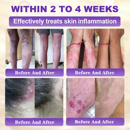 Made and Shipped from USA ✨Evolvion® Biotin 10-in-1 Skin Restoration Cream🌻🌻