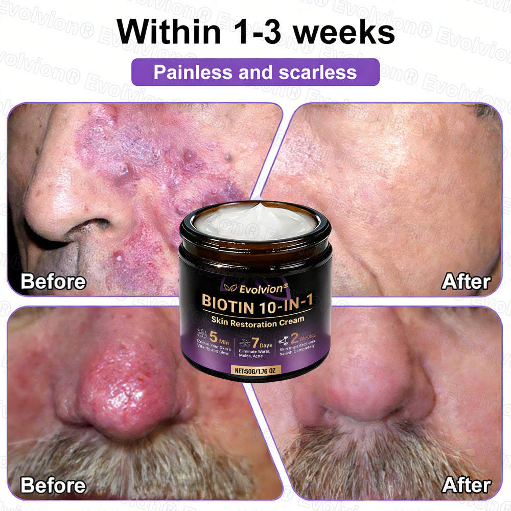 Made and Shipped from USA ✨Evolvion® Biotin 10-in-1 Skin Restoration Cream🌻🌻