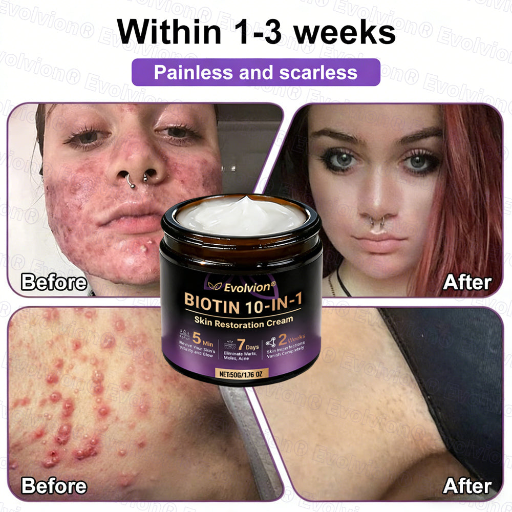 Made and Shipped from USA ✨Evolvion® Biotin 10-in-1 Skin Restoration Cream🌻🌻