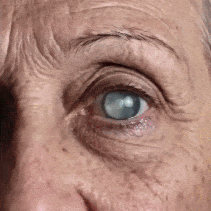 Rekulo® OptiMist Eye Spray✅FDA Approved (For dry eyes, blurry vision, eye strain, presbyopia, and cataracts) 👀 🌻 up